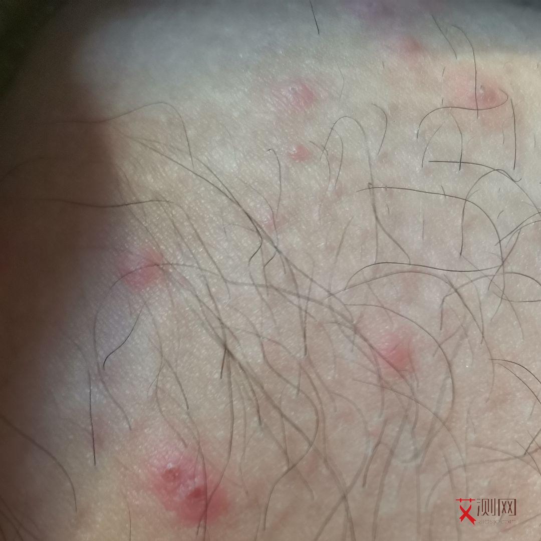 艾滋病试纸有效时间