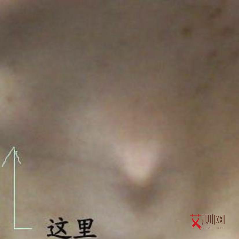 患上艾滋病是什么症状