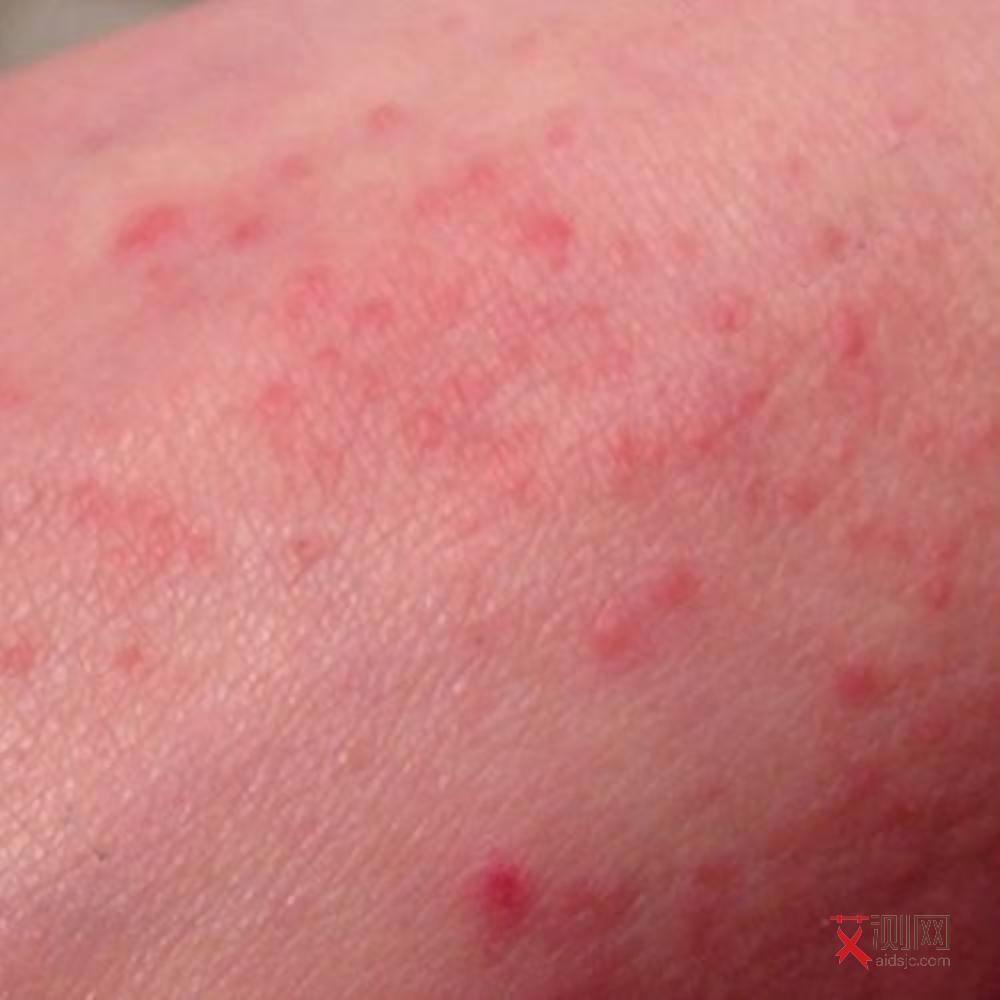 怎么才能看出有没有艾滋病