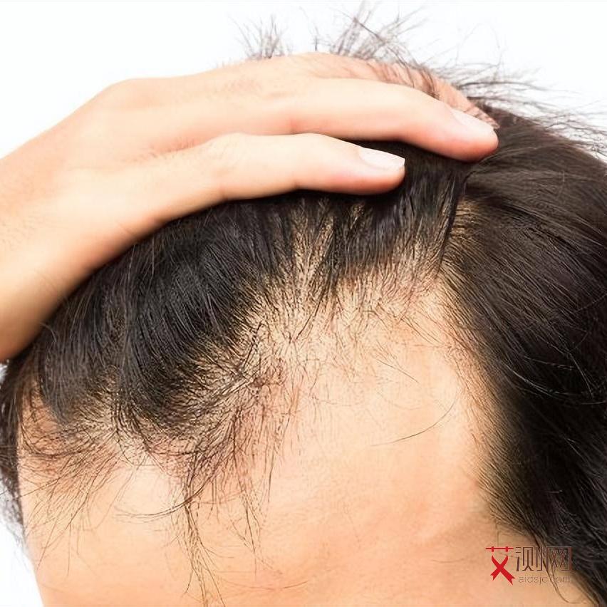 艾滋病会痒吗早期图片女性症状是什么样的