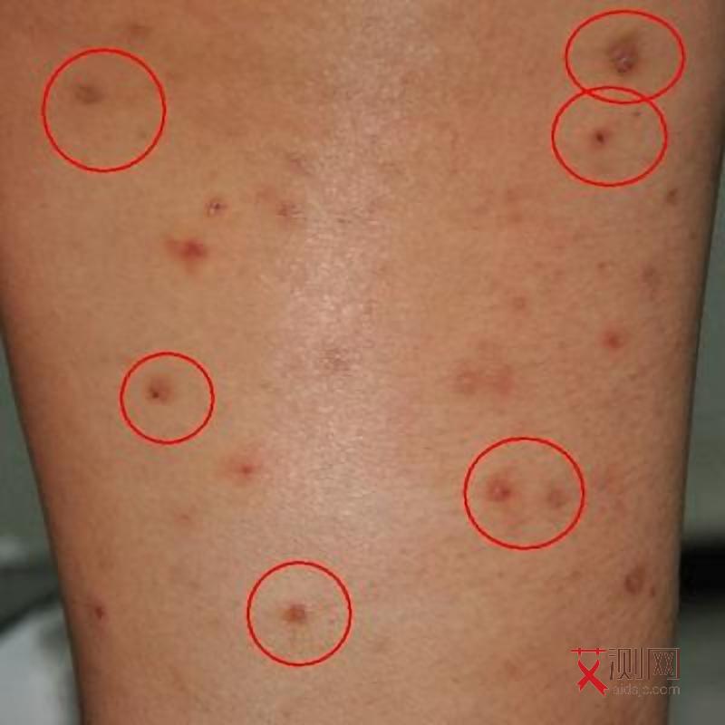 艾滋病占全国比例