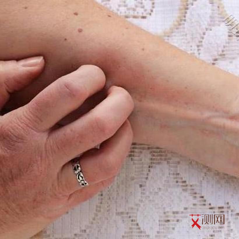 艾滋病有几个症状就确诊为是艾滋病病毒吗