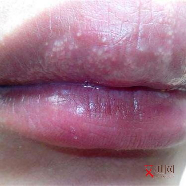 艾滋病到底多久能查出来是否感染成功