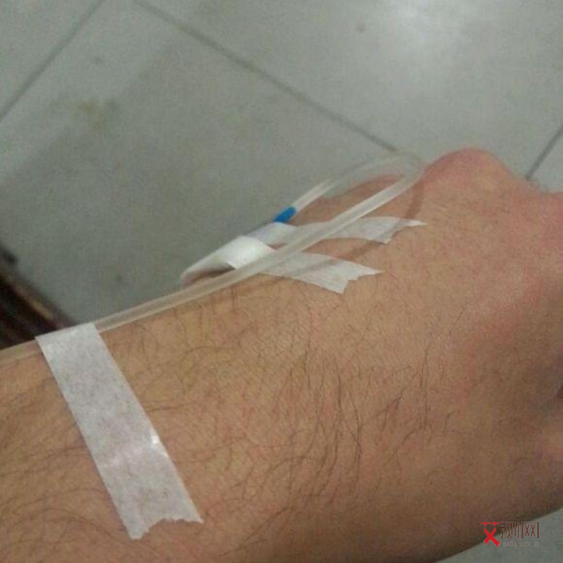 艾滋病引起淋巴肿大了危险吗