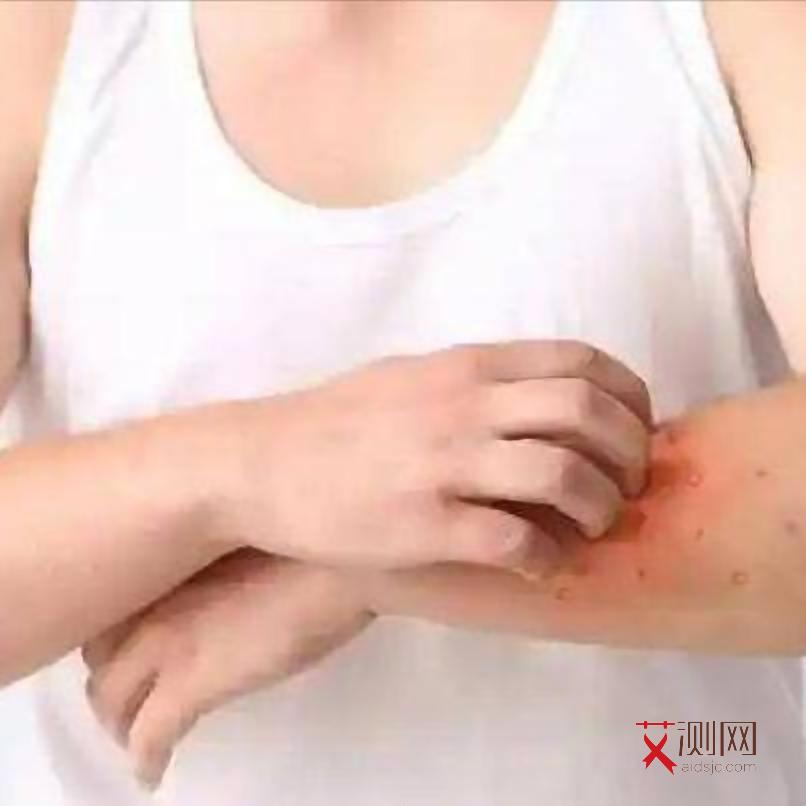 抓了艾滋病人的皮肤一下