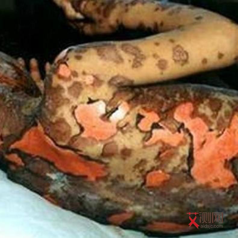 艾滋病男性潜伏期传染女的概率高吗