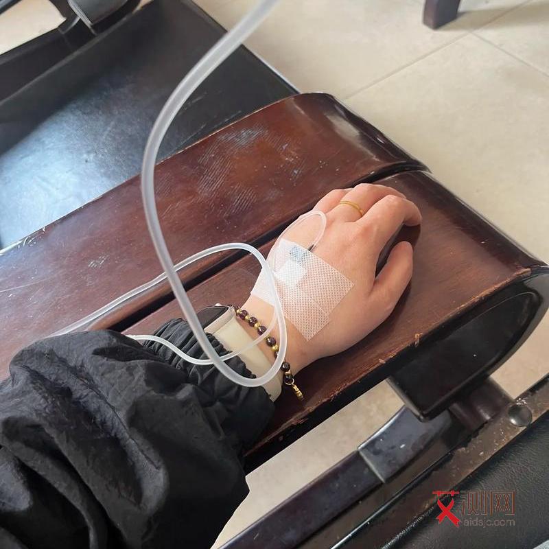 艾滋病皮肤是怎么样