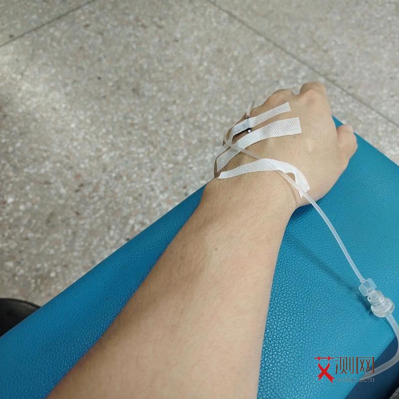 艾滋病的皮肤症状和一般皮肤病的区别是什么