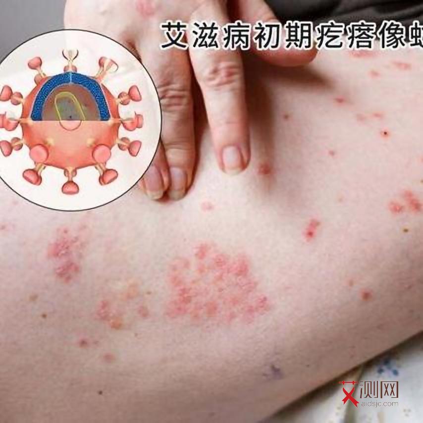 艾滋病多久能检查出抗体阳性和阴性