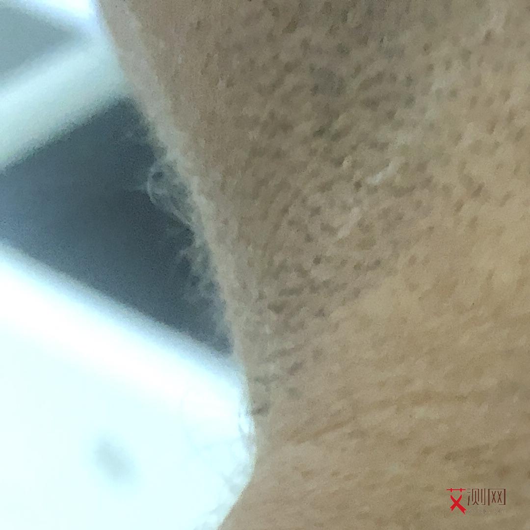 高危后如果感染艾滋病毒多久会出现症状