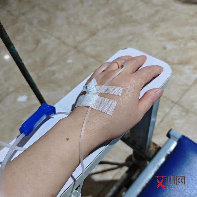 感染艾滋病多久身上会出现皮疹