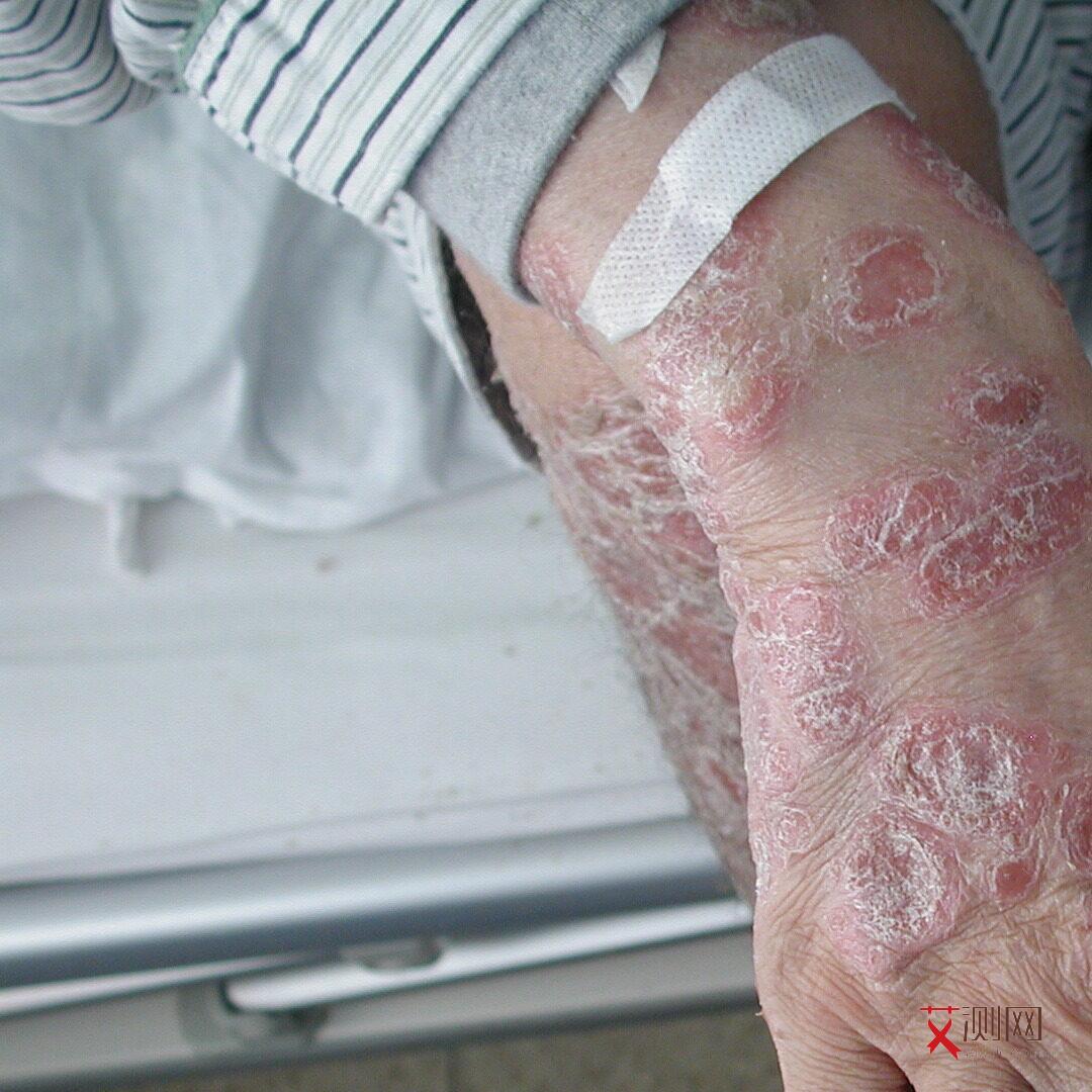 艾滋病哪些算高危行为呢