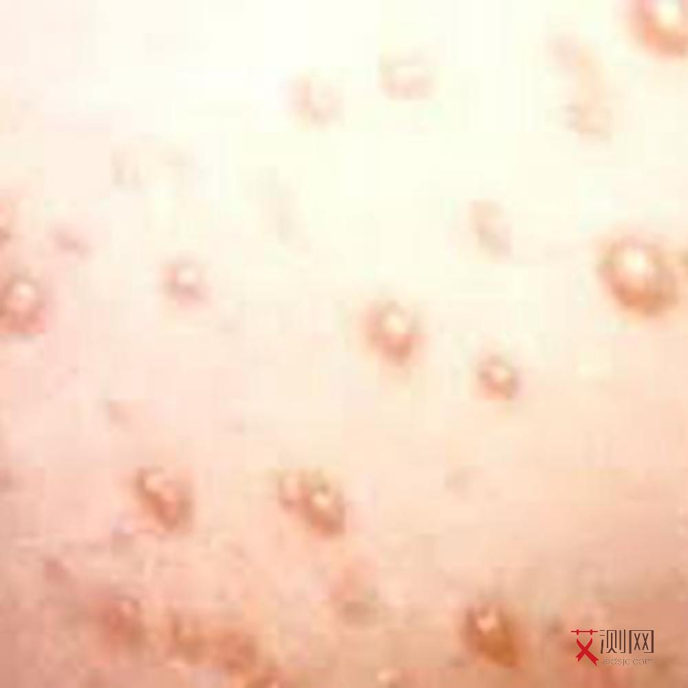 艾滋病女生下面会长痘痘吗会传染吗