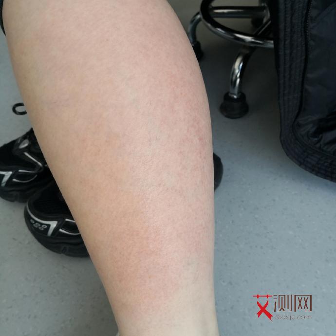 感染艾滋病多久会死