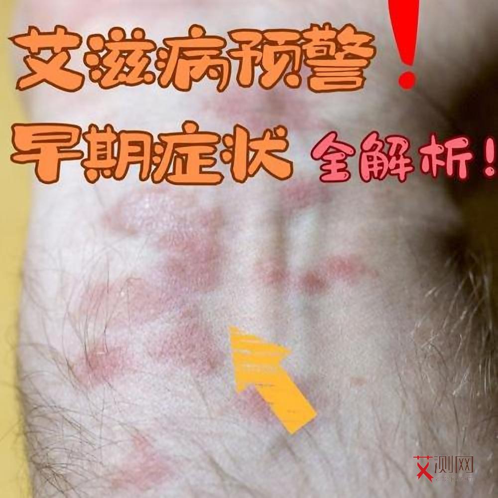 如何判断女性有没有艾滋病感染