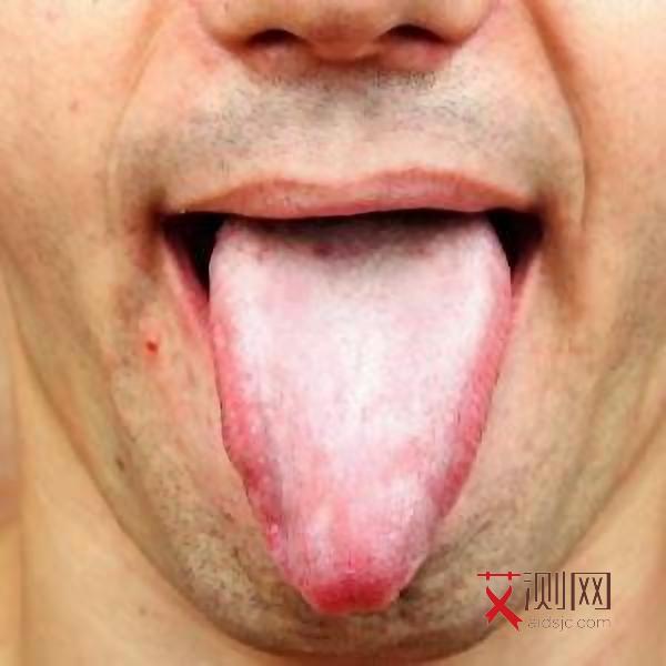 怎么检查自己有没有艾滋病毒抗体检测结果呢