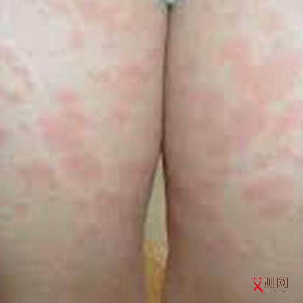 查自己是否有艾滋病怎么查