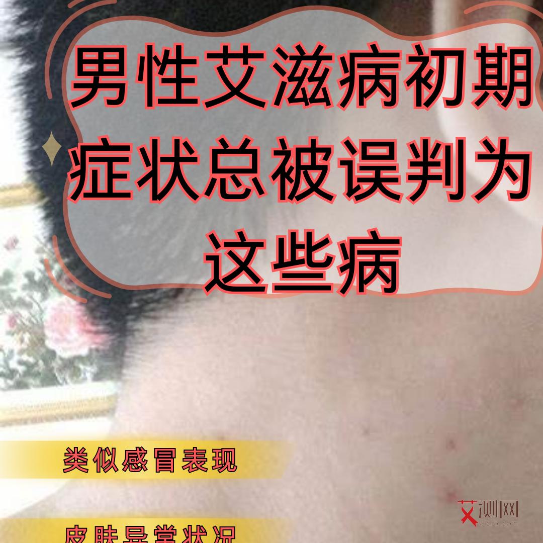 疾控中心对于艾滋病感染者处理流程及时间要求