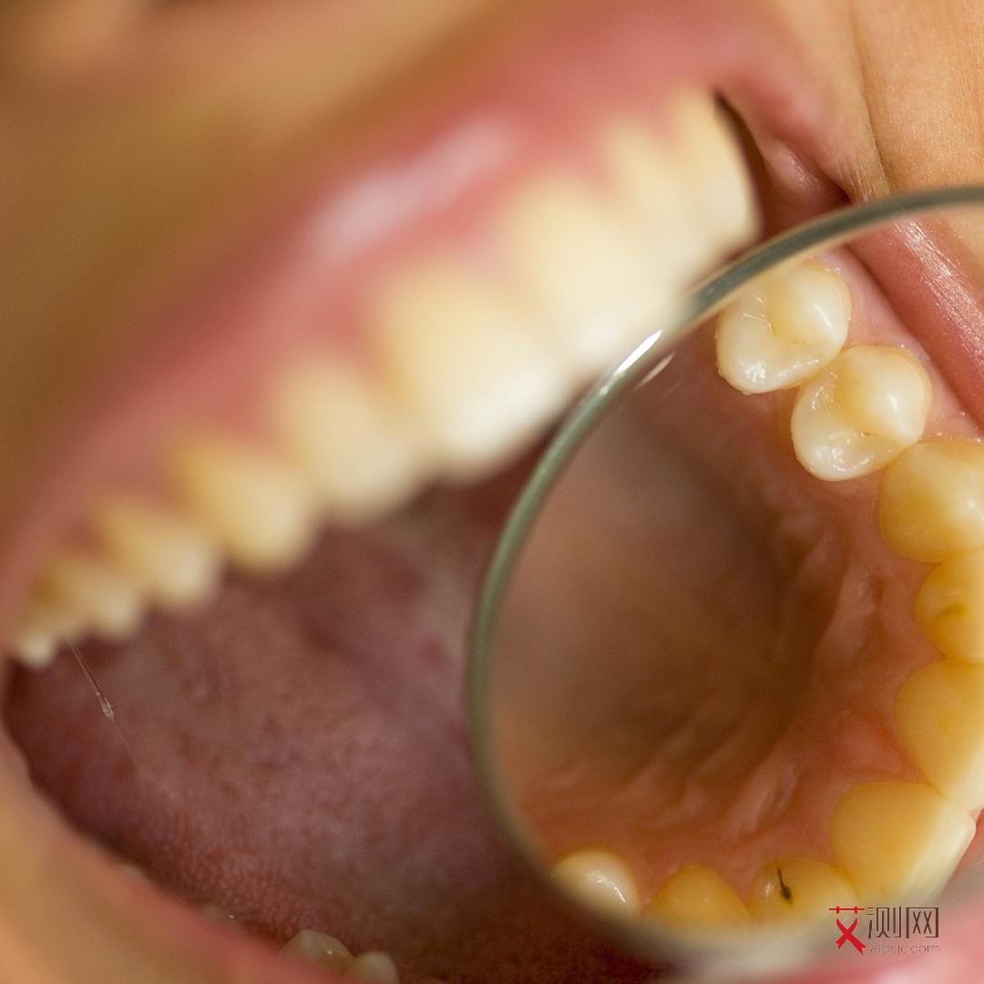 艾滋病患者最明显的症状是哪种情况