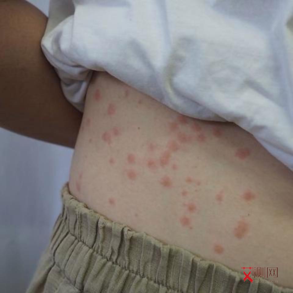 一般艾滋病多久发病一次