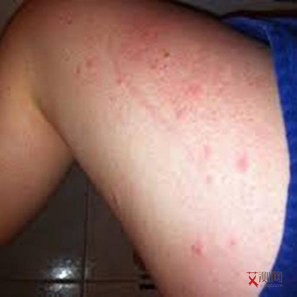 艾滋病得病的几率多大