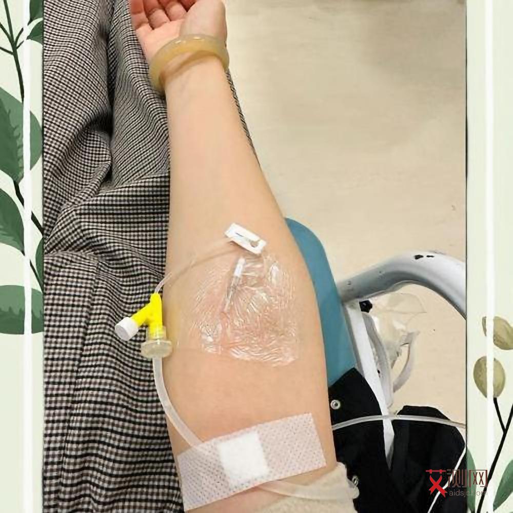 艾滋病下体有什么症状表现男性