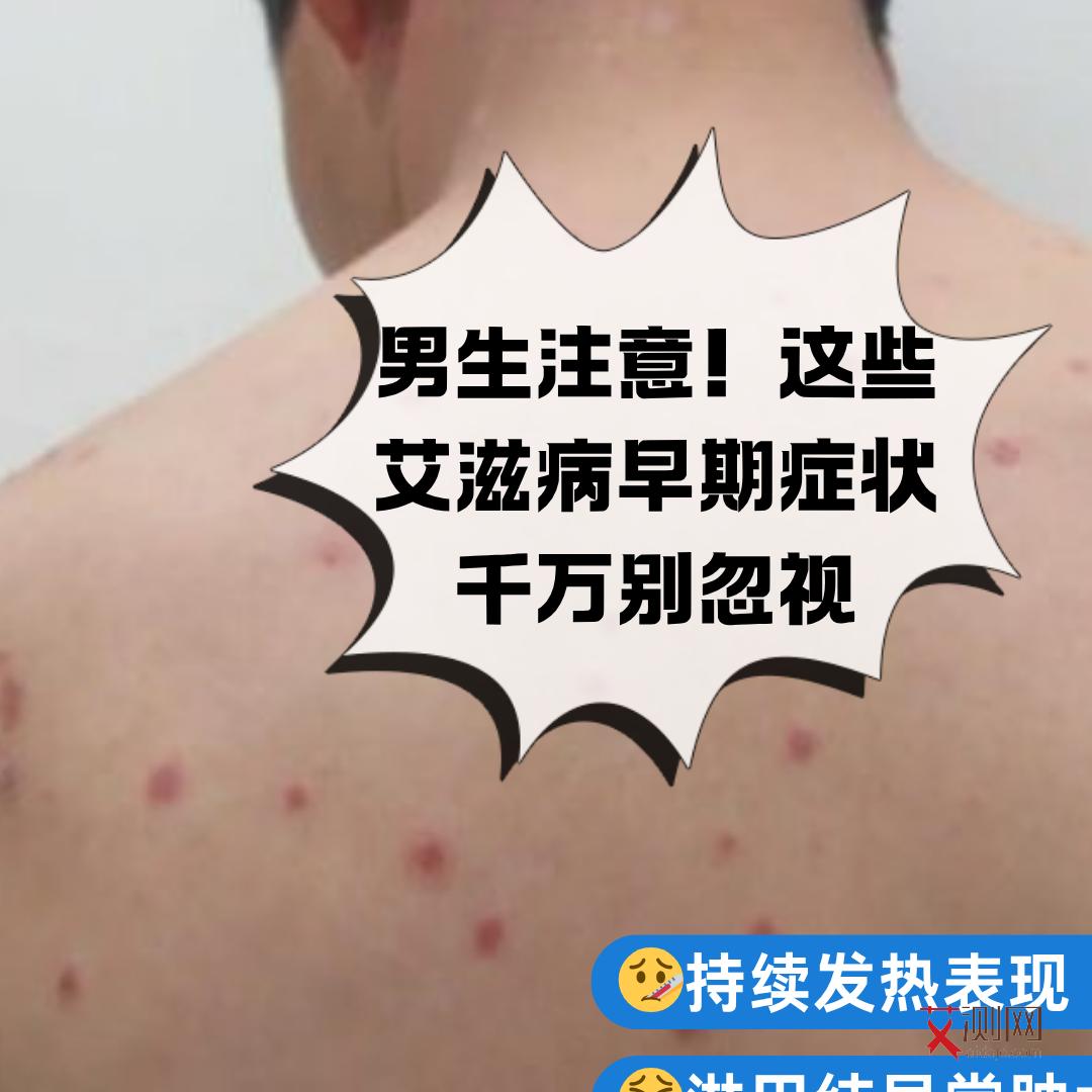 艾滋病患者下体症状图片大全图解