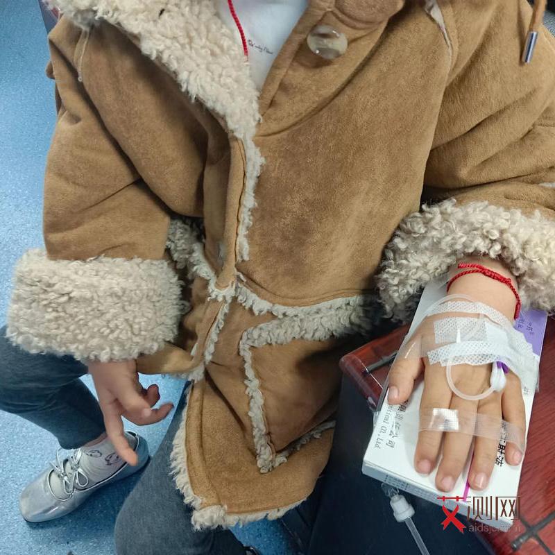 艾滋病初期小红点多少个才算