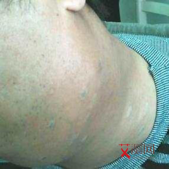 艾滋病多久可以确认没有感染