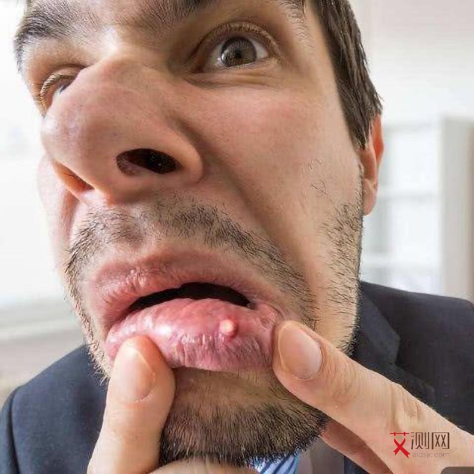 男性艾滋病是什么症状反应