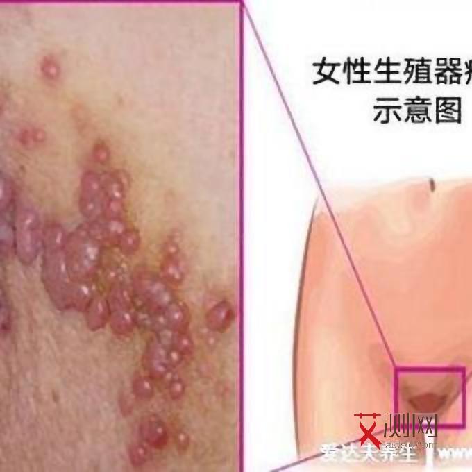 献血怎么知道有没有艾滋病呢