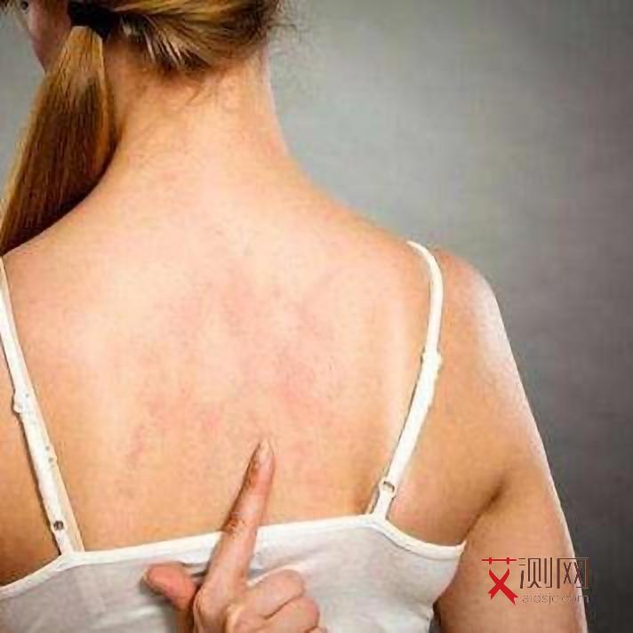 艾滋病多久才会发现得上身传染呢