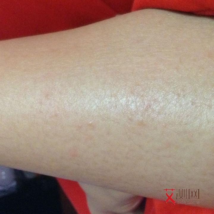 艾滋病症状多长时间出现一次表现正常呢图片男