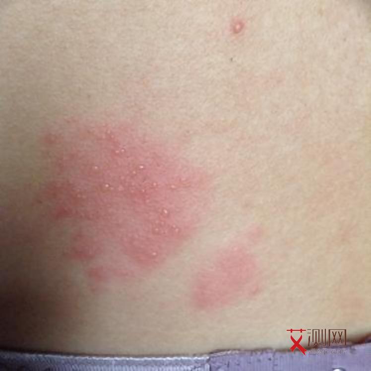 艾滋病会不会怀孕生孩子