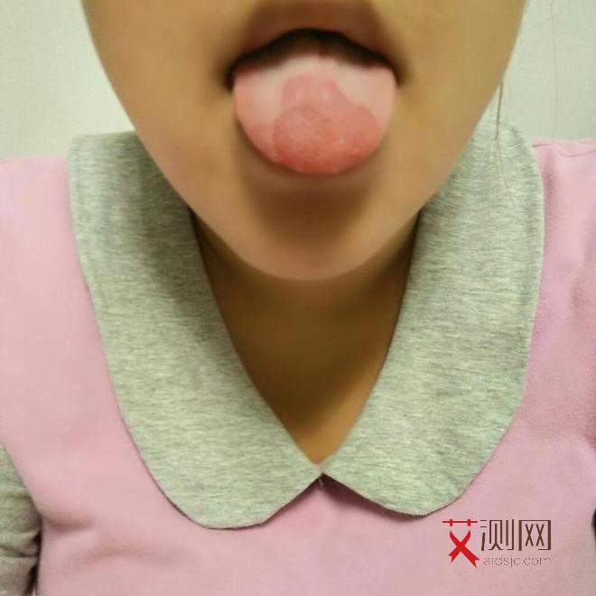 艾滋病感染多久后可以检测出抗体阳性