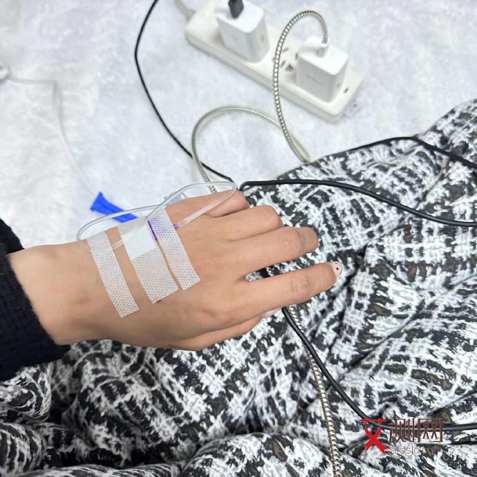 出现淋巴结肿大艾滋试纸阴性正常吗