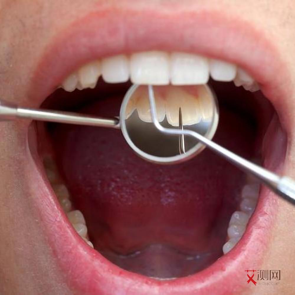 艾滋病前期有什么表现和症状