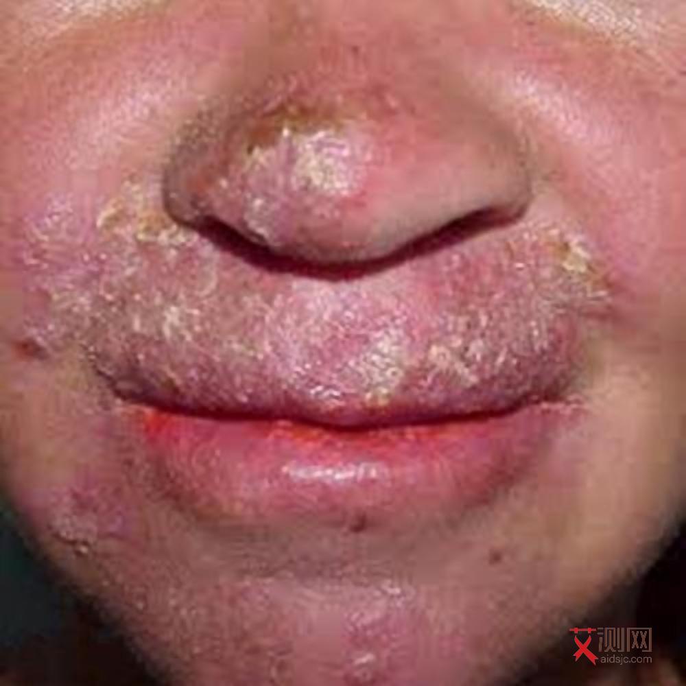 艾滋病试纸会有艾滋病毒吗