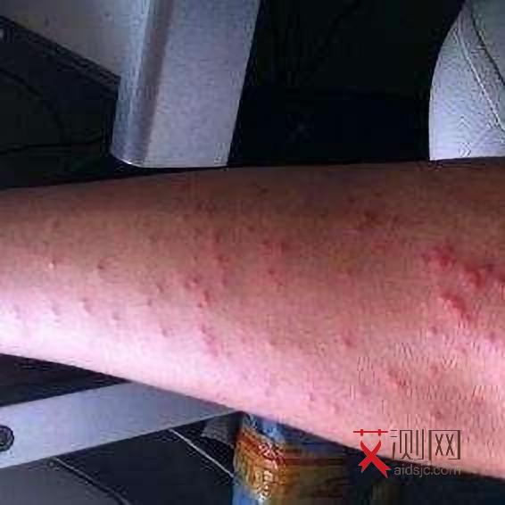 艾滋病多久会显现