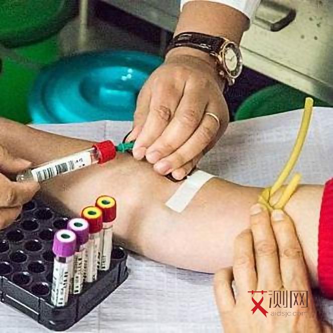 艾滋病人唾液含有病毒吗