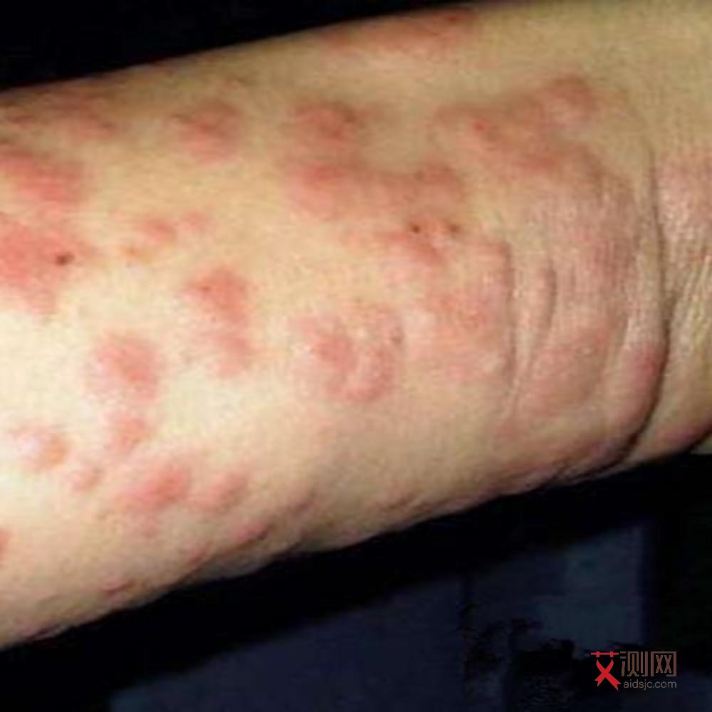 没有高危会得艾滋么