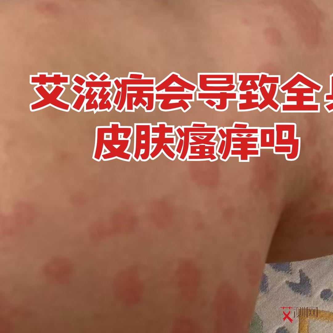 艾滋病人身上出现红点怎么办图片大全