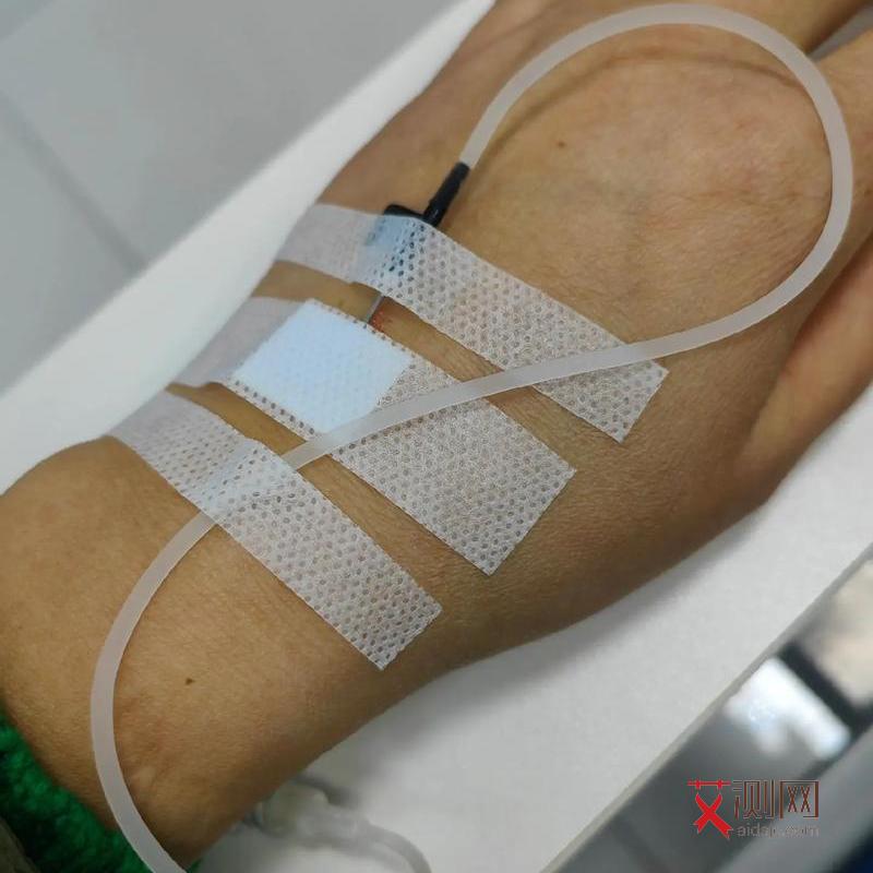 艾滋病患者图片全身后期