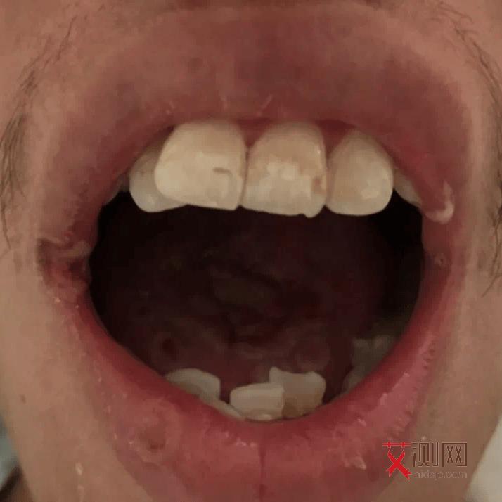 女艾滋病人的月经症状有哪些呢图片