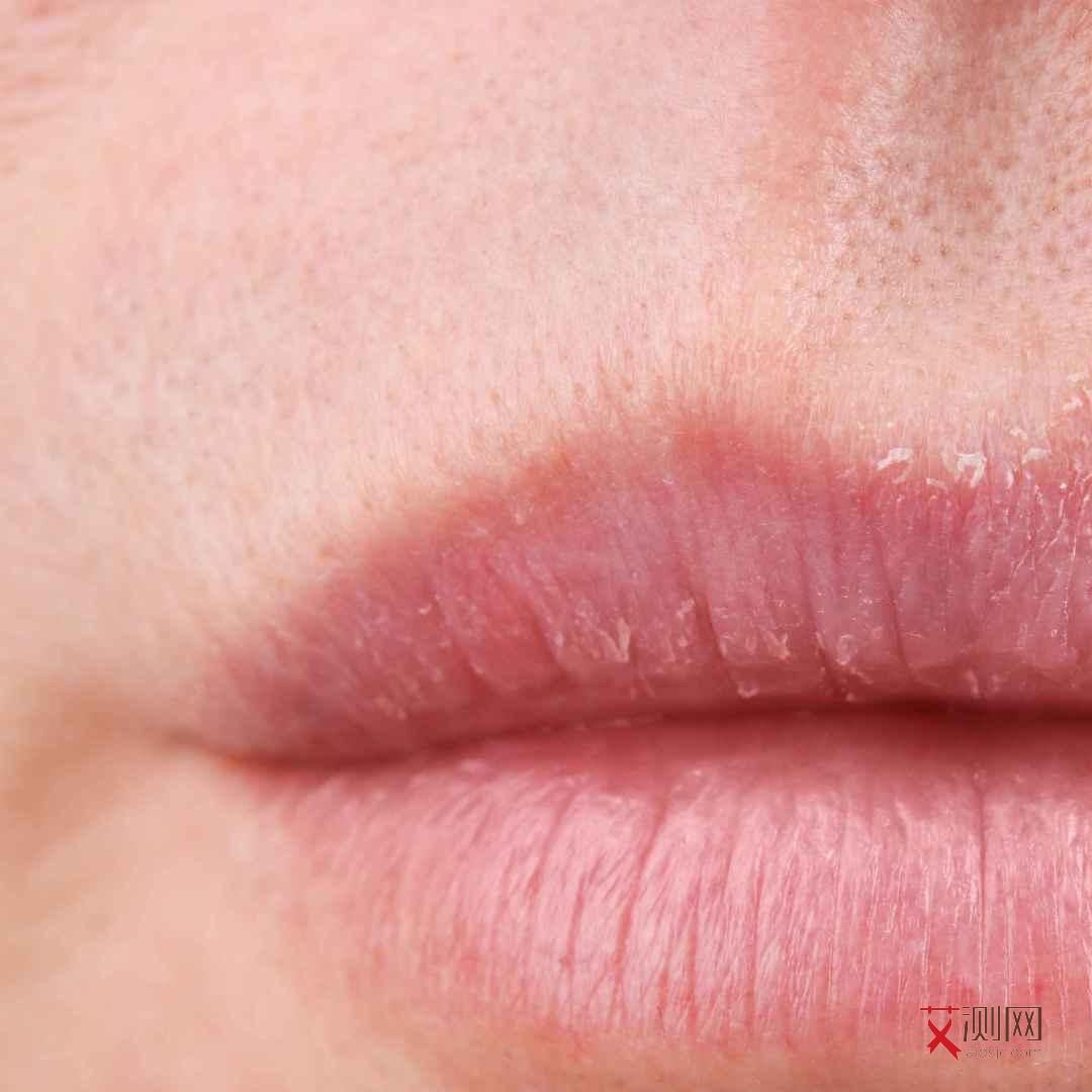 得艾滋病得症状是什么样子的