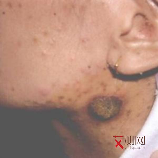 艾滋病来事正常么会传染吗女性