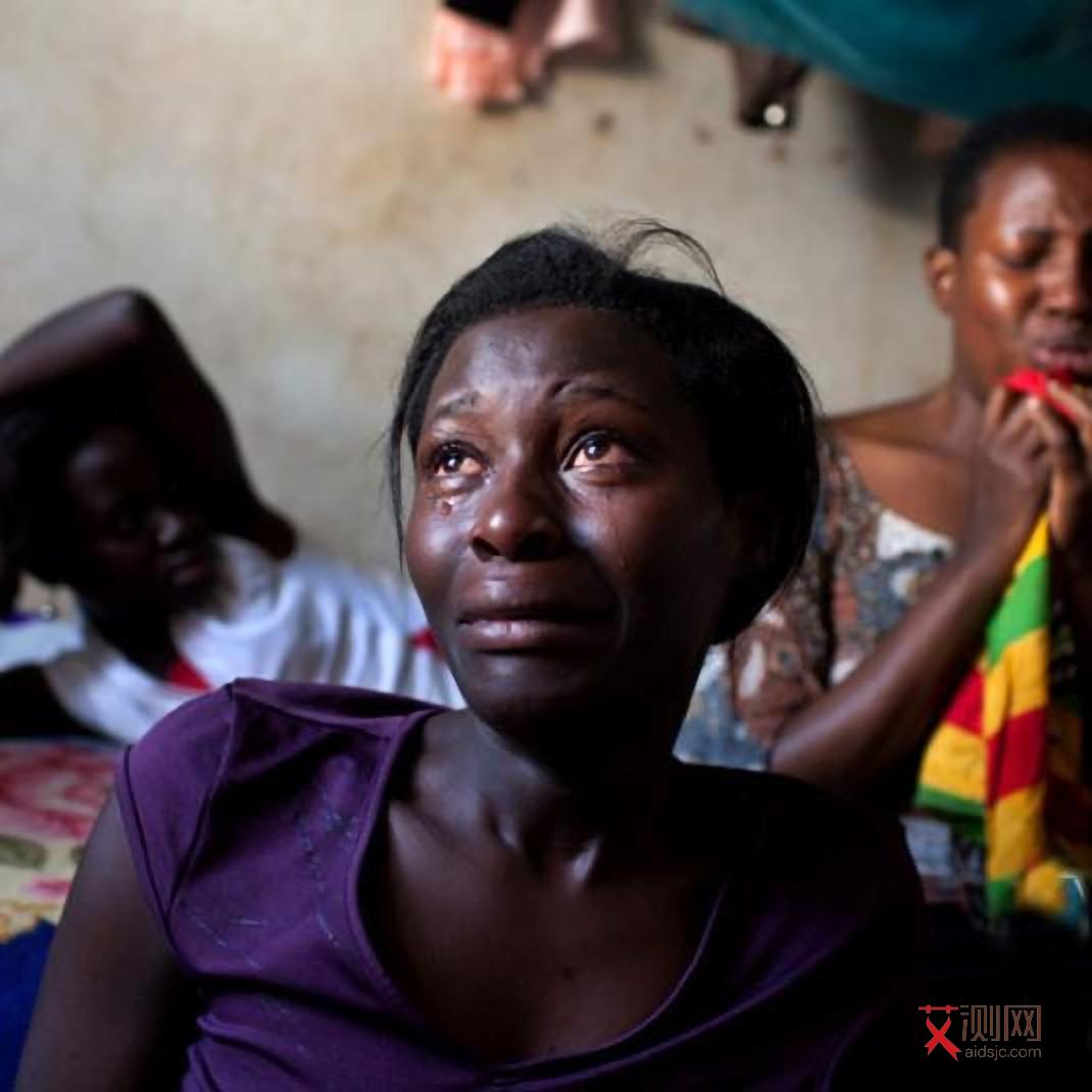 艾滋病的皮疹的症状是什么