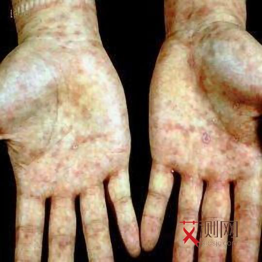 出现了艾滋病的所有症状表现为什么