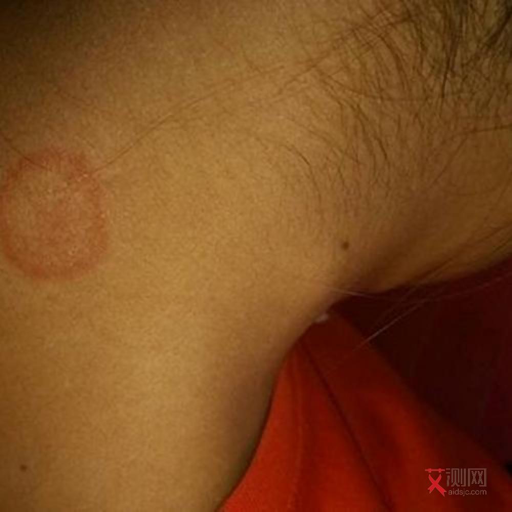 一般多久进行艾滋病抗体检测