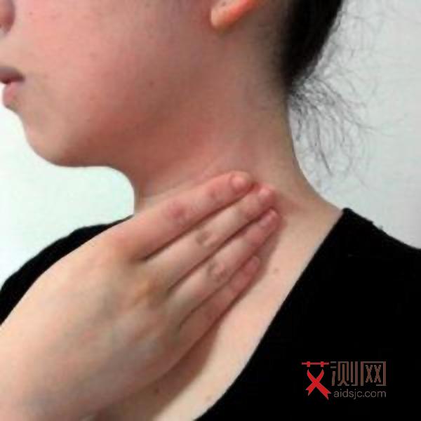 艾滋病多久能检查出来多久能完全排除